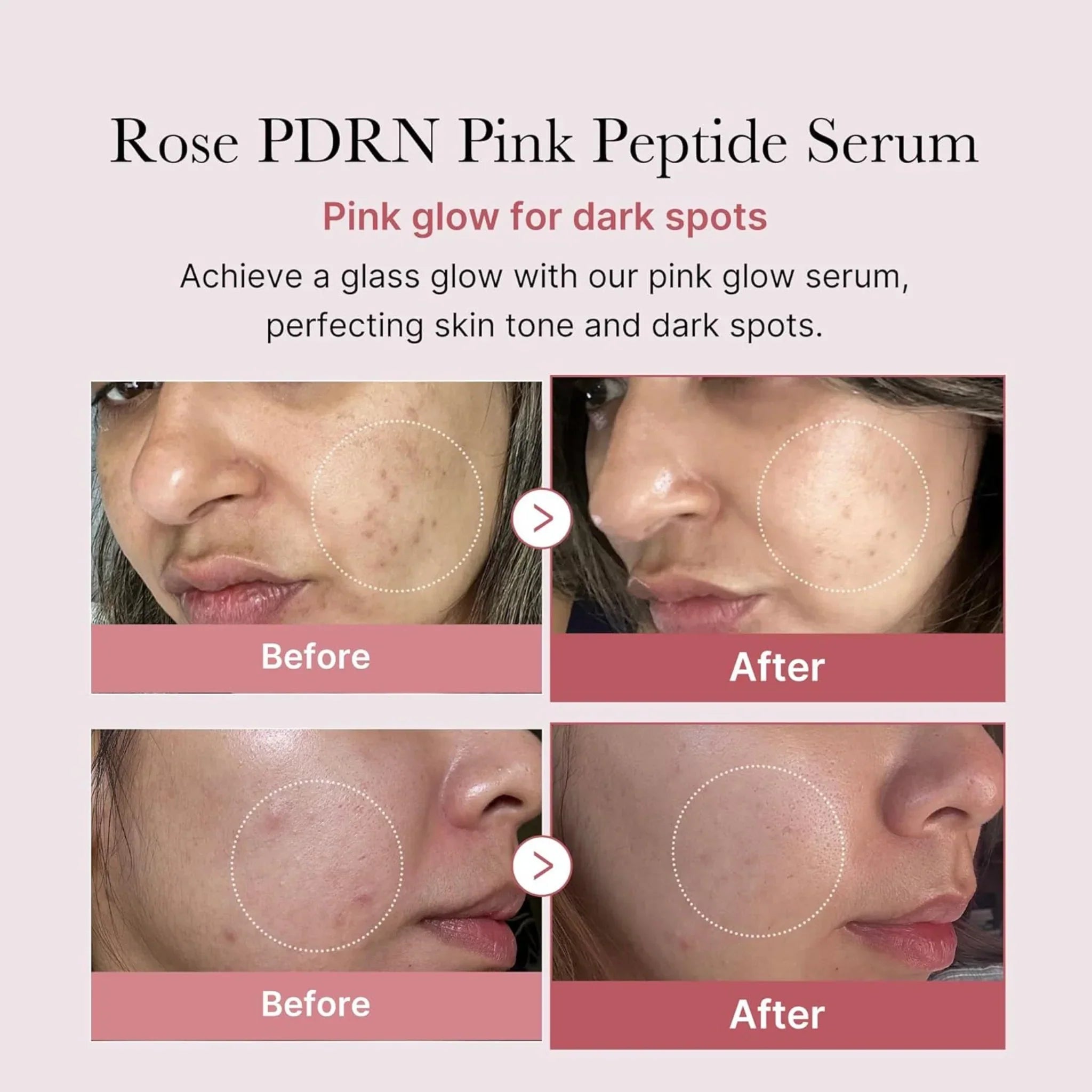 Medicube PDRM Pink Peptide Serum 30ml